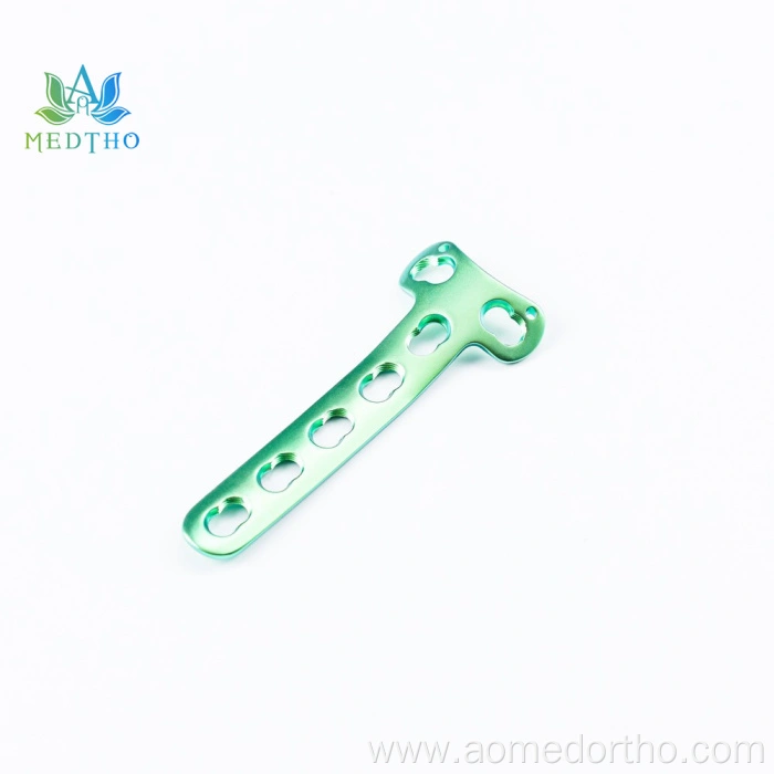 proximal lateral tibia locking plate